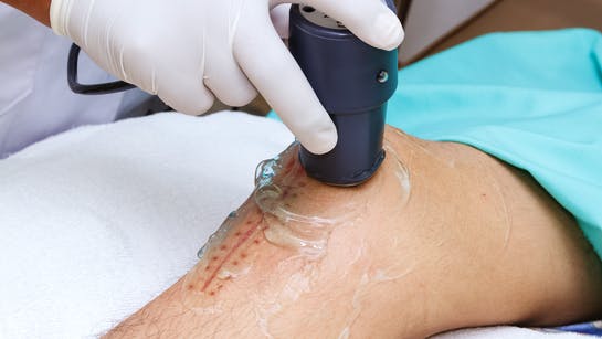 Einsatz eines Ultraschallgeräts am Knie im Rahmen der Physiotherapie Einsatz eines Ultraschallgeräts am Knie im Rahmen der Physiotherapie